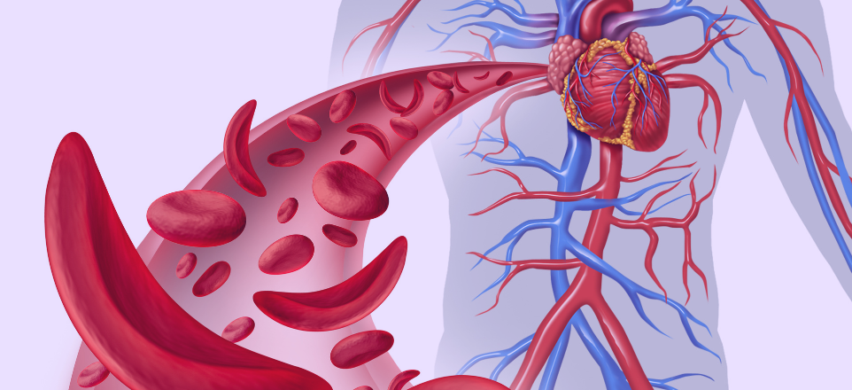 How Medspartner Supports Sickle Cell Patients in High-Cost Healthcare Systems