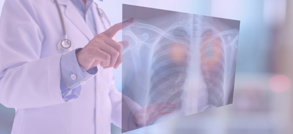 Affordable Gefitinib for EGFR-Mutated Lung Cancer - Generic Alternatives to Branded Iressa®