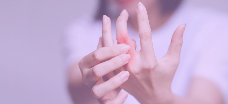 Affordable Olumiant® (Baricitinib) for Rheumatoid Arthritis and Alopecia Areata